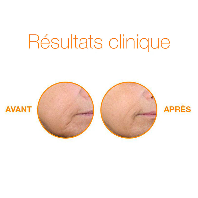avant- après - Sérum Eclat Biolumin-C - Dermalogica - Marine Lemaitre Skincare - Soin peau Nantes