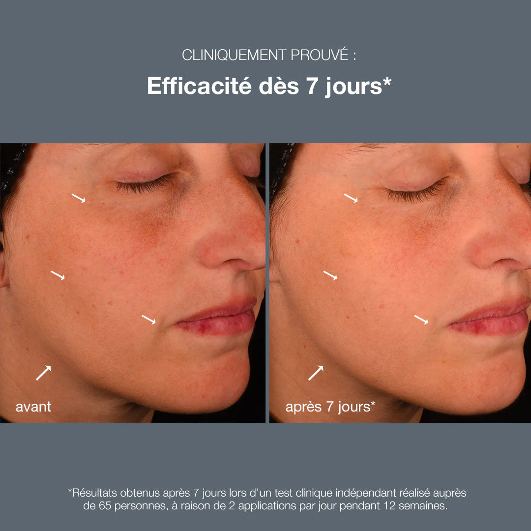 Avant-après - Sérum anti-âge Dermalogica - Marine Lemaitre Skincare - Soin peau Nantes