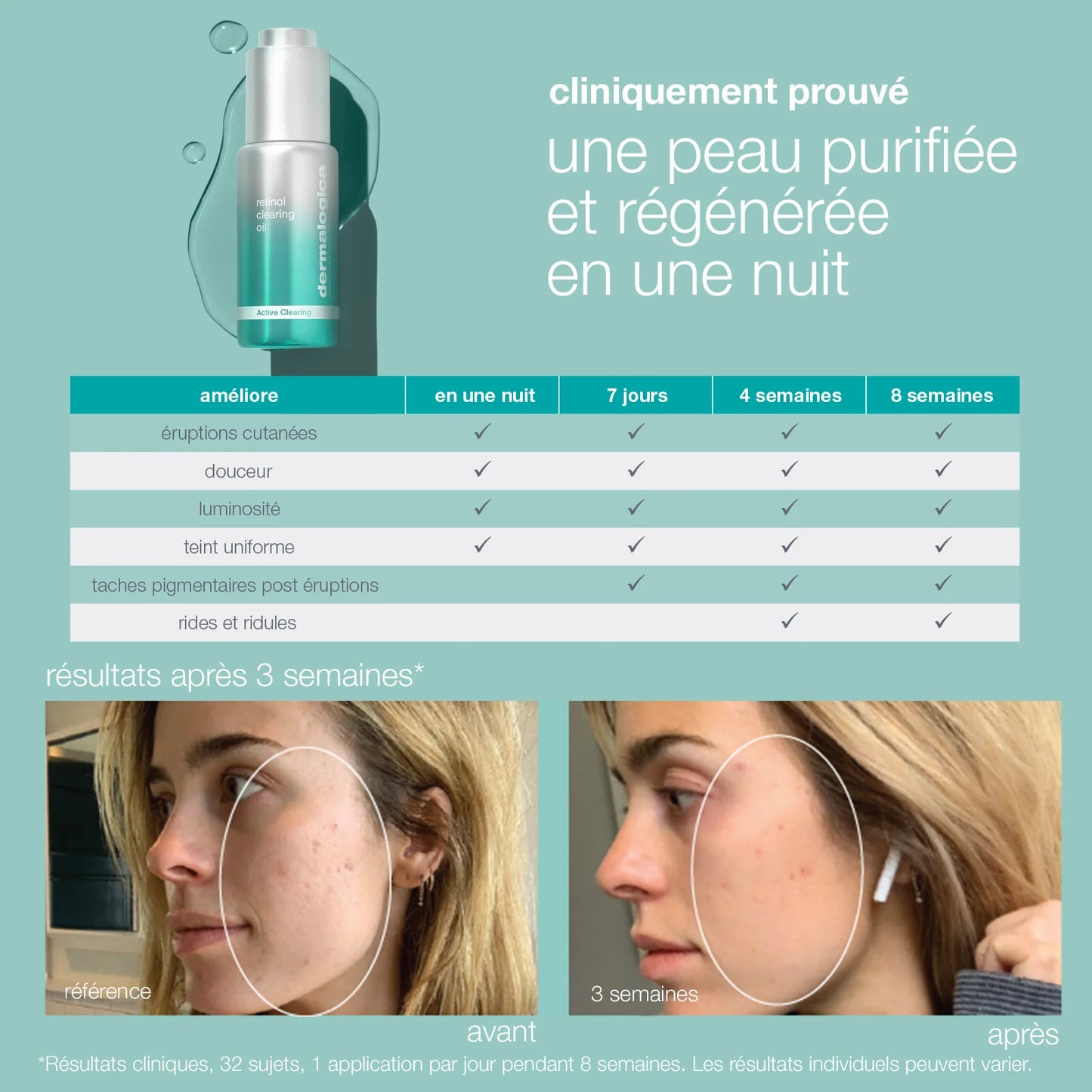 Résultats - huile de nuit purifiante au rétinol - Dermalogica - Marine Lemaitre Skincare - Soin Peau Nantes