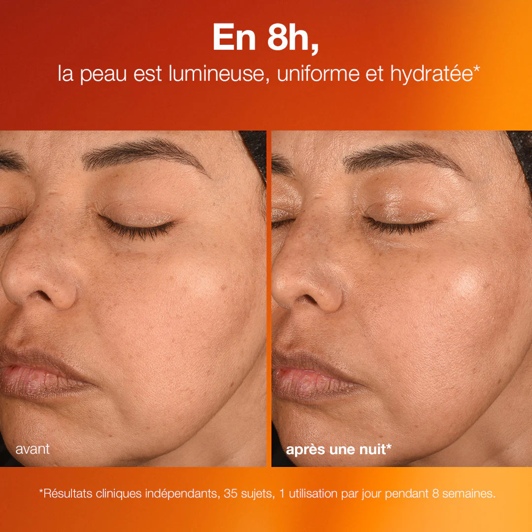 Avant-après - Serum de nuit Vitamine C Dermalogica - Marine Lemaitre - Soins Peau Nantes