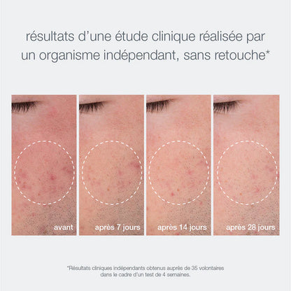 Poudre exfoliante Dermalogica résultats Marine Lemaitre Skincare