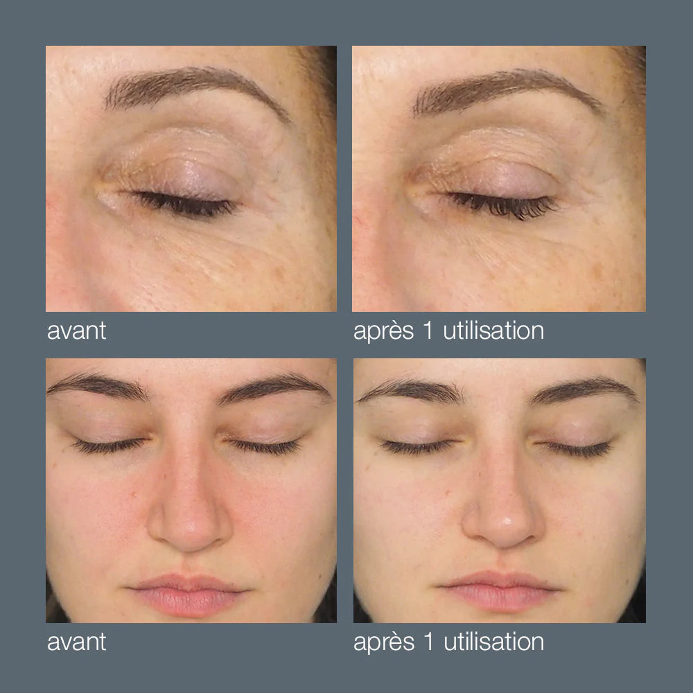daily milkfoliant resultats Marine Lemaitre Skincare Dermalogica